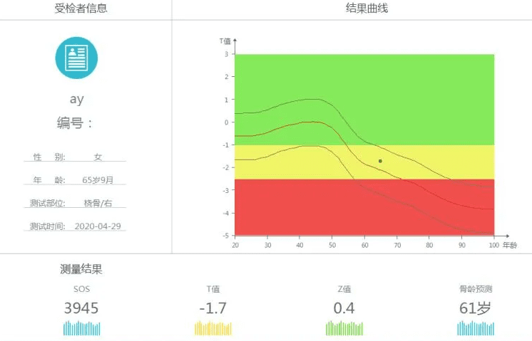 骨密度檢測儀器